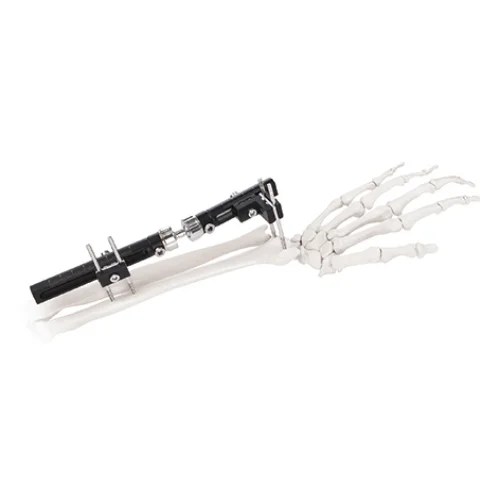 Wrist Joints External Fixator
