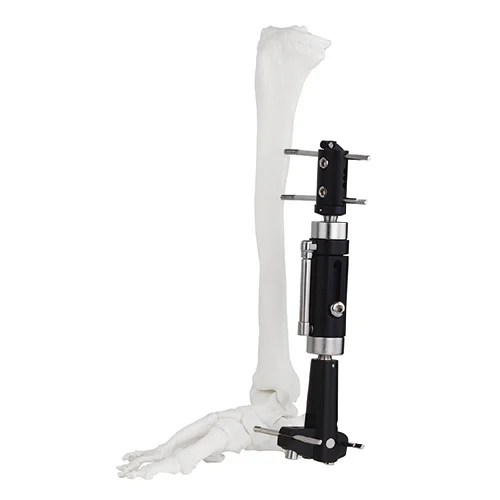 Ankle Joint Fragment External Fixator