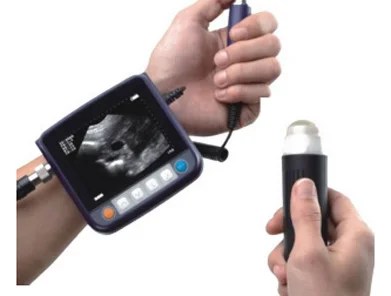 MiniScan Veterinary Mini Ultrasound Scanner Designed For Small And Large Animal Pregnancy