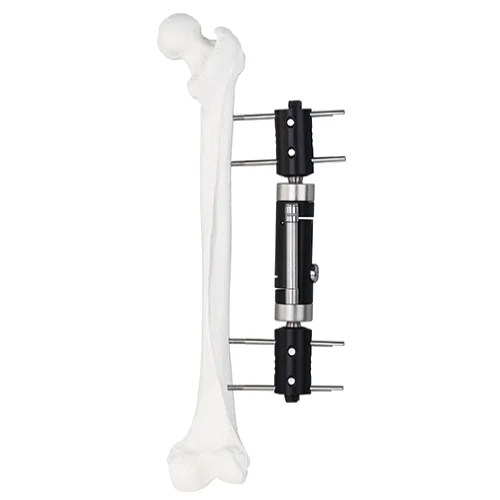Straight Type External Fixator