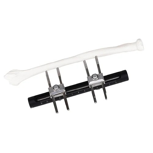 Wrist Joints External Fixator