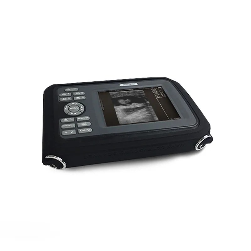 Medical Device Diagnostic Portable Digital Ultrasound Scanner SONO R
