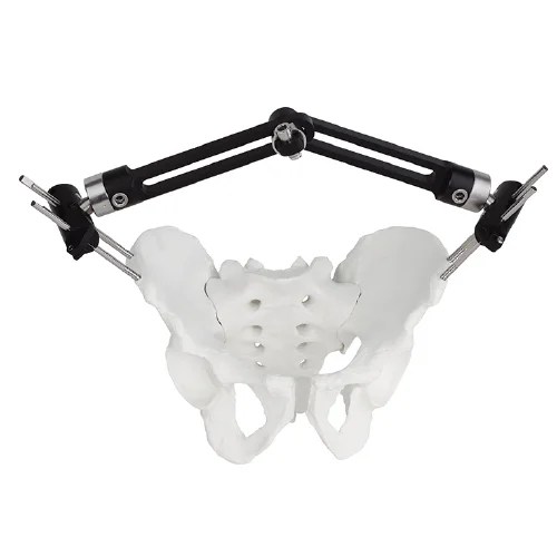 Pelvic Fragment External Fixator - Type B