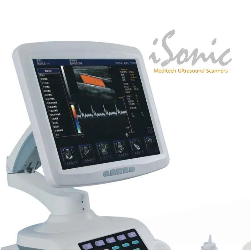 iSonic High Quality Images Color Ultrasound Scanner