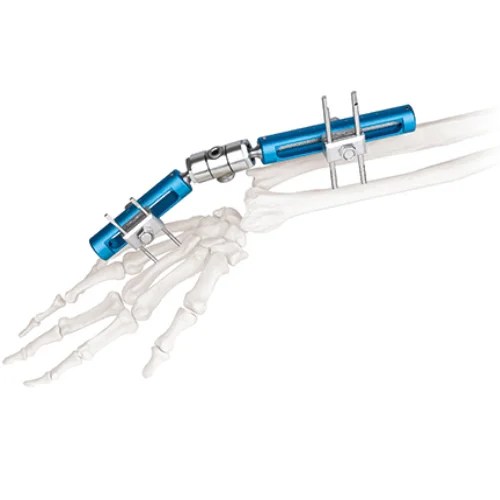 Wrist Joints External Fixator