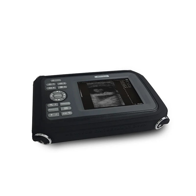 Medical Device Diagnostic Portable Digital Ultrasound Scanner SONO R